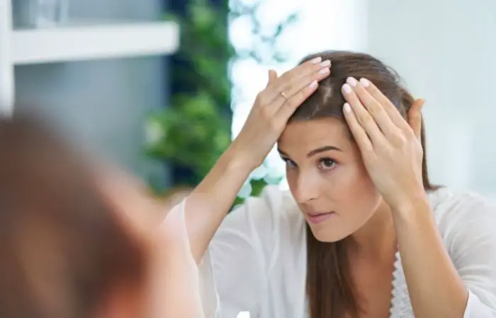 Dandruff Causes and Solutions [Get Rid Of It]
