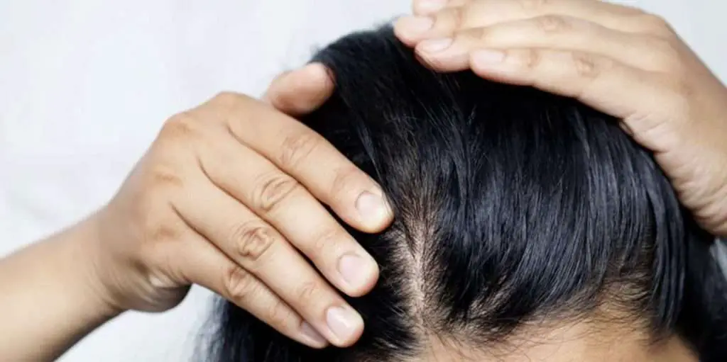 Woman checking her itchy scalp to tell if her hair is greasy
